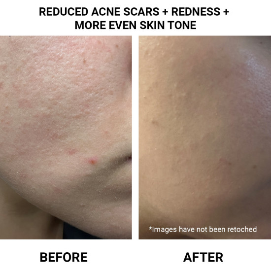 Ethereal Elixir Rosehip + Carrot Seed Anti-Aging Acne-Prone Skin Face Oil