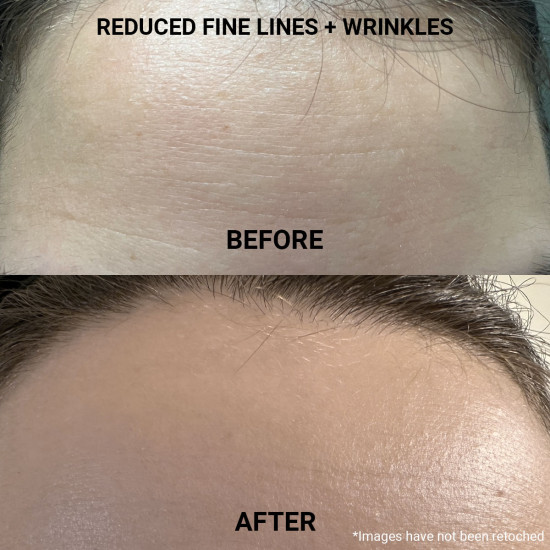 Ethereal Elixir Rosehip + Carrot Seed Anti-Aging Acne-Prone Skin Face Oil